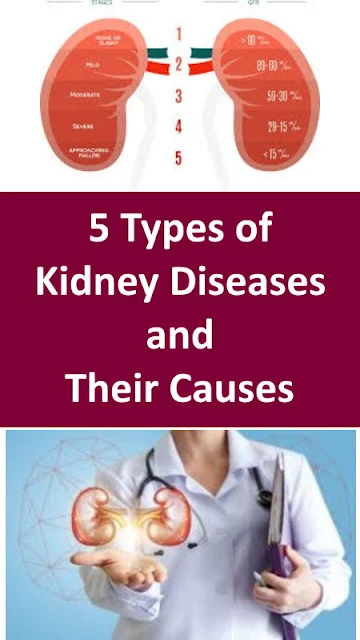 5 Types of Kidney Diseases and Their Causes