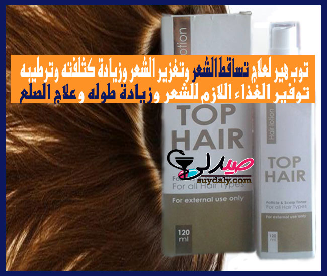 توب هير لوسيون Top Hair lotion لتساقط الشعر وتغزيره وزيادة كثافته وترطيبه  وعلاج الصلع البدائل والسعر في 2022