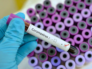 Covid-19 or Coronavirus vaccine image 