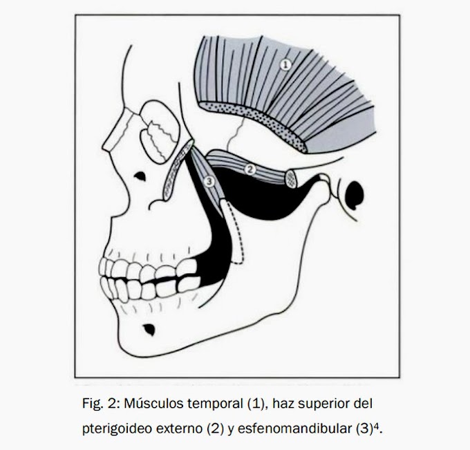 PDF: Revisión narrativa del tratamiento fisioterápico de la Disfunción Temporomandibular en pacientes pediátricos 