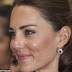 Mengejar hidung sempurna Kate Middleton