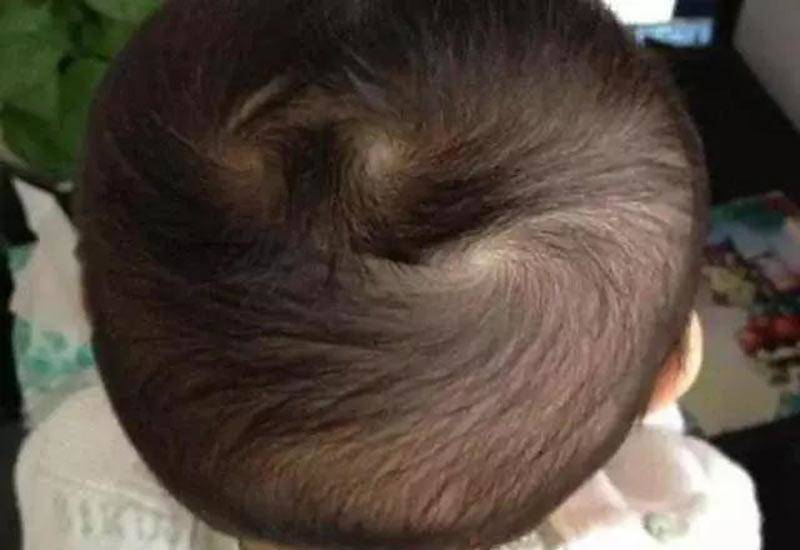 Nhìn xoáy tóc biết vận mệnh: Trẻ có 2 xoáy đầu thường nghịch ngợm, tài giỏi hơn người