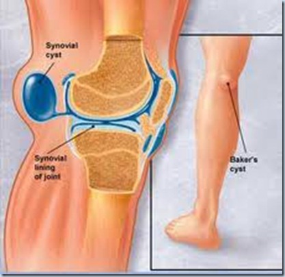 persendian lutut
