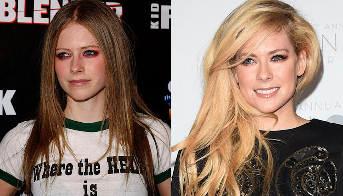 Efecto Avril Lavigne: lo que contribuye y dificulta a mantener una piel joven