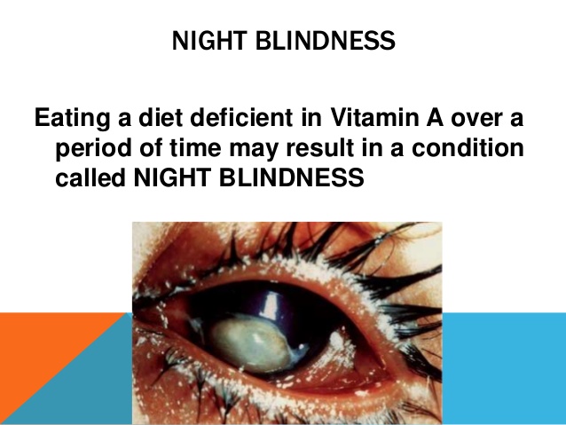 Design 35 of Night Blindness Vitamin A Deficiency