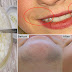 How To Remove Unwanted Facial Hair Within A Few Minutes!