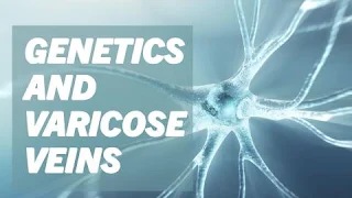 Do Genetics Play a Role in Developing Varicose Veins?