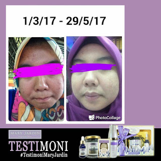 Testimoni Detox Clay Mask Mary Jardin Cerahkan Muka