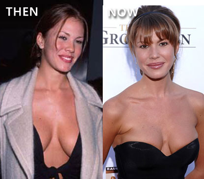 Chatter Busy: Nikki Cox Surgery