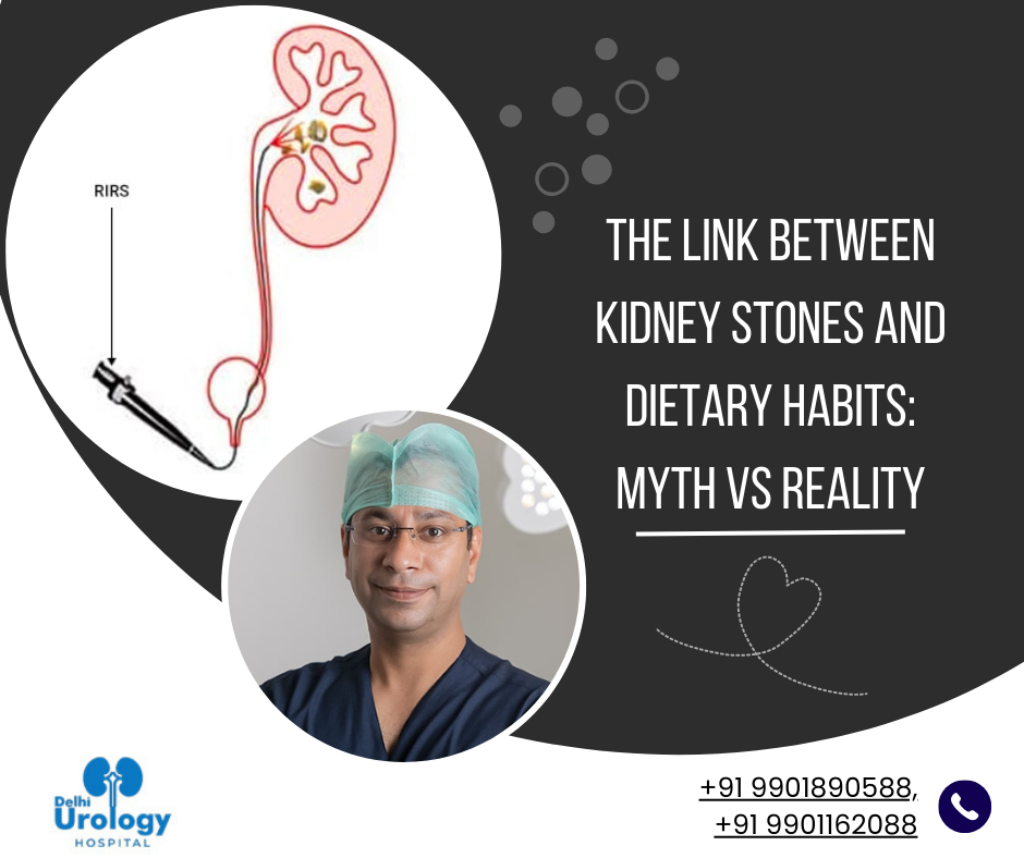 Kidney Stone Surgery in Delhi