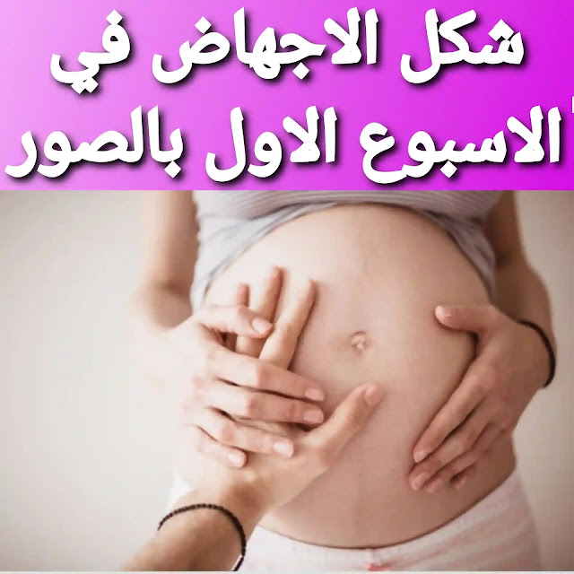 شكل إجهاض الجنين في الأسبوع الأول