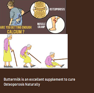 Buttermilk is a Good Calcium Rich Supplement for Osteoporosis