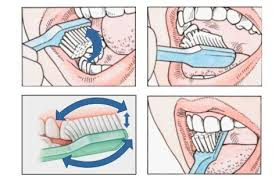 Tips Perawatan Gigi