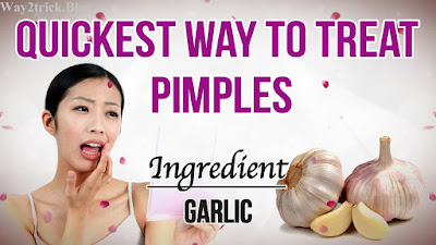 How to Get Rid of Pimples Fast