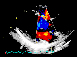 Echocardiography