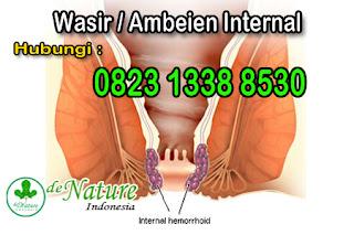 obat-ambeien-wasir-di-apotik-paling-ampuh-sembuh-total-tanpa-operasi