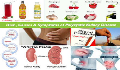 ayurvedic treatment for polycystic kidney disease