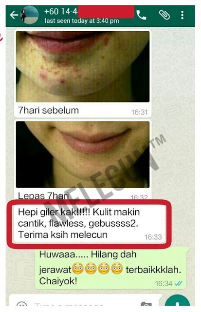 TESTIMONI MELECUN SCRUB