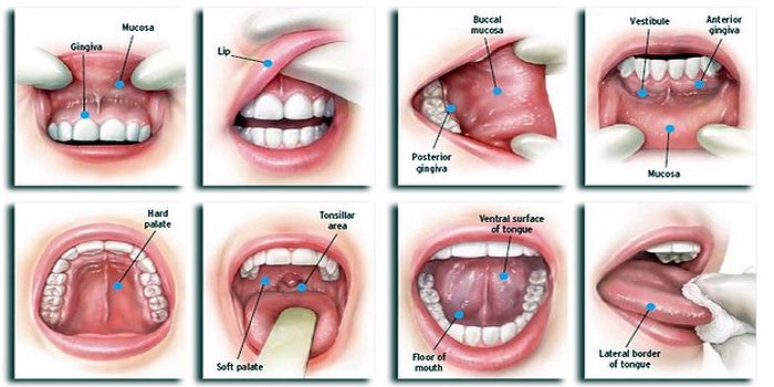 Oral Medicine