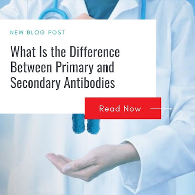 primary antibody and secondary antibody