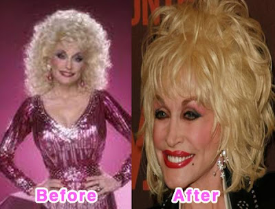 Celebrity Plastic Surgery Disasters