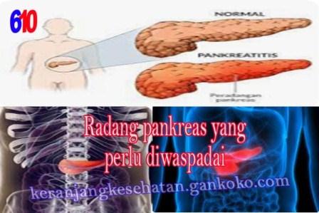 https://keranjangkesehatan.gankoko.com/2023/10/radang-pankreas-yang-perlu-diwaspadai.html