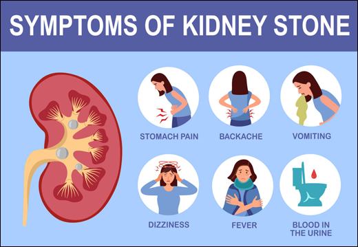 How to dissolve kidney stones, Natural Home remedy for Stones, Natural Home remedy, Dissolve Kidney Stones, Ayurvedic medicines, Symptoms, causes, Ayurvedic treatment