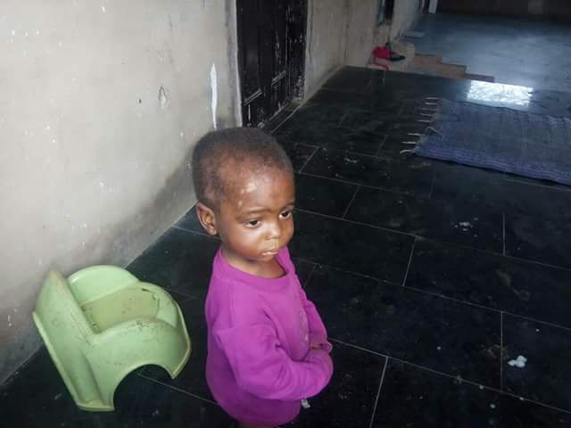 Photos: Department of Public Prosecution takes over case of 2-year-old boy maltreated by his father and stepmother in Edo