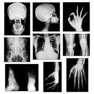 Digital X-ray Scan