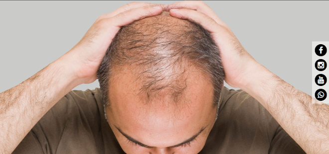 Hair Transplant Cost In Delhi