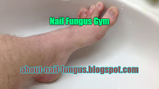 Nail Fungus Gym