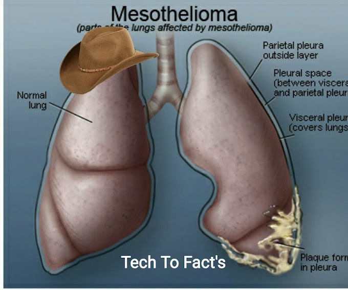 What is Mesothelioma? 