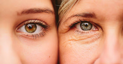 Aging signs