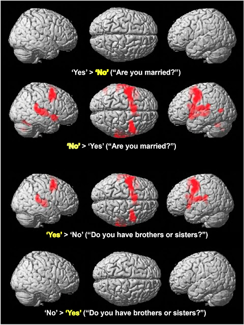 Brain Yes4