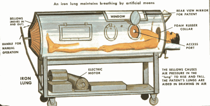 iron lung diagram