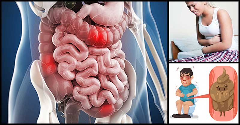 Foods To Avoid When Suffering From Constipation Last News