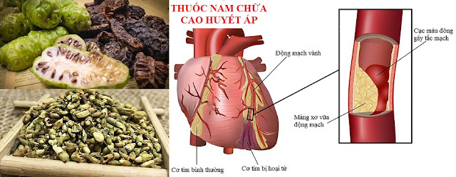 PHÒNG CHỮA BỆNH NHỜ RAU CỦ QUẢ QUANH TA - THUỐC NAM CHỮA CAO HUYẾT ÁP