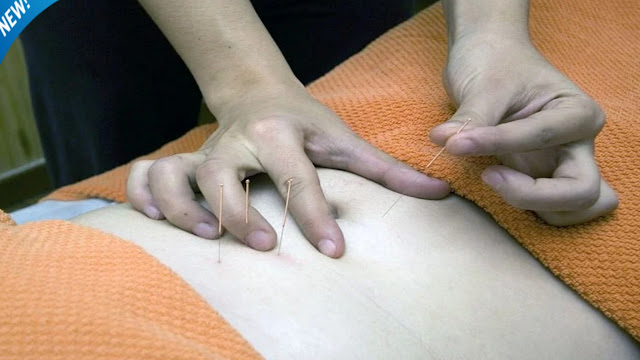 Acupuncture,What is acupuncture and how does it help?,Can acupuncture be harmful?,What does acupuncture treat?,Acupuncture points,Acupuncture needles,What does acupuncture treat,Acupuncture for back pain,How does acupuncture work, Acupuncture benefits and risks,How do you know if acupuncture is working,Is acupuncture painful
