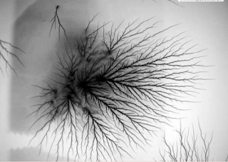 static artifacts on radiograph