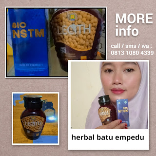 Herbal batu empedu