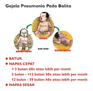 Pneumonia pada balita memberikan gejala batuk, napas cepat dan sesak napas