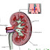 Causes and Stages of Chronic Kidney Disease (CKD)