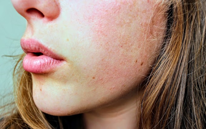 7 Foods That Can Be Dangerous for Your Skin