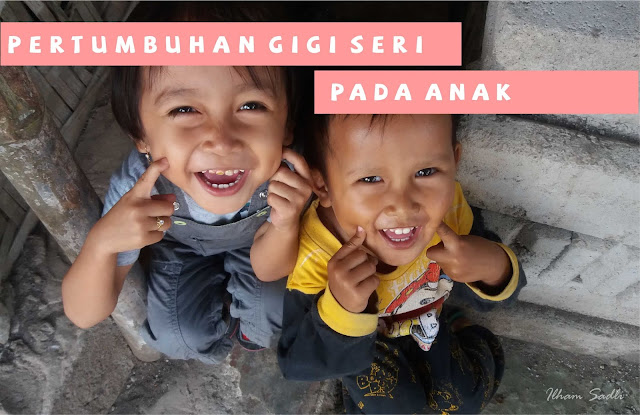 Pertumbuhan Gigi Seri Pada Anak