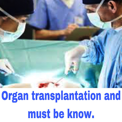 what is Organ transplantation do you know.?