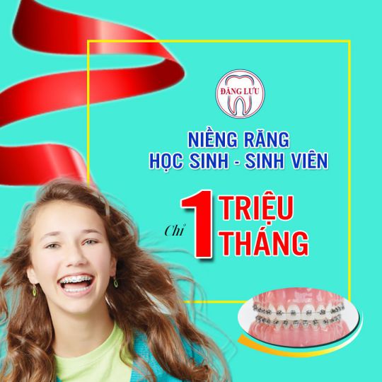 Niềng răng 3D clear