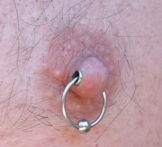 Techniques and Risks of Nipple Piercing