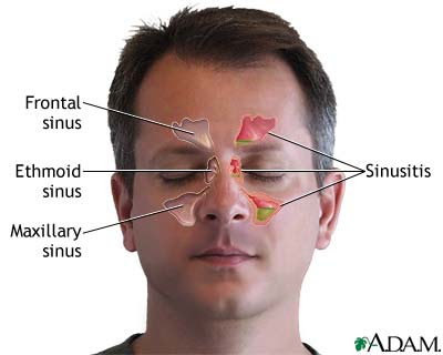 Sinus Pressure Points