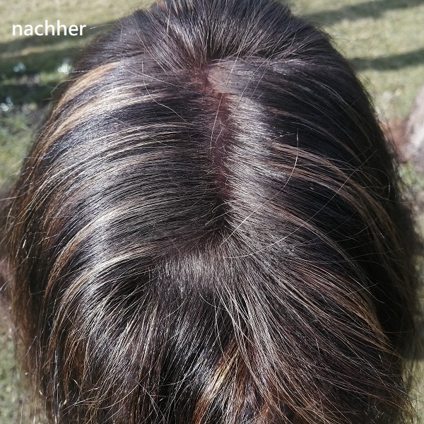 Haar nachher
