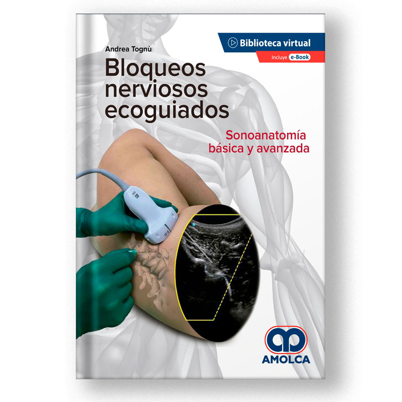 Andrea Tognú Bloqueos nerviosos ecoguiados ed 2020 pdf